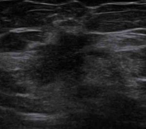 Ultrasound Imaging in Mumbai, India - Advanced Diagnostics at Picture This